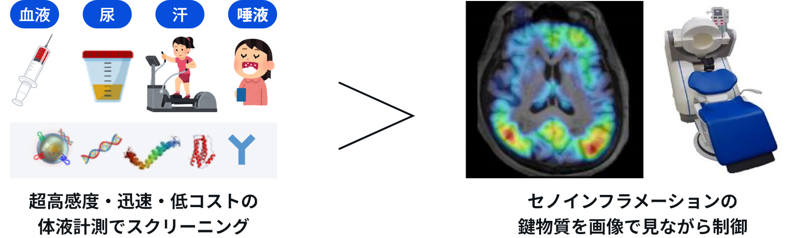 セノインフラメーションの鍵物質を画像で見ながら制御、超高感度・迅速・低コストの体液計測でスクリーニング